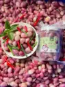 Hành Tím Ngâm 700G /Pickled Shallots